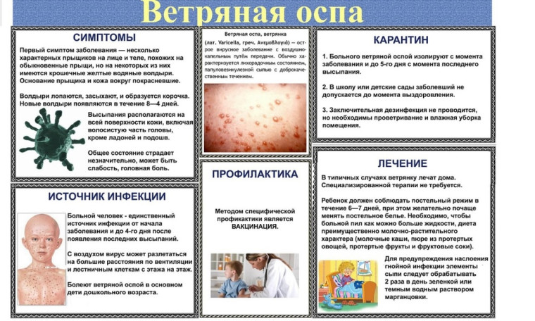 Ветряная оспа.